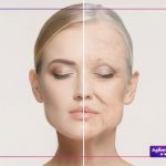 علل و راه های درمان چروک شدن پوست صورت