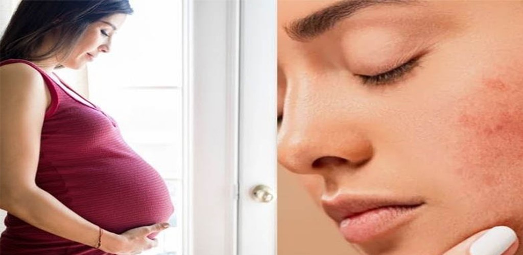 تغییرات پوستی طی دوران بارداری